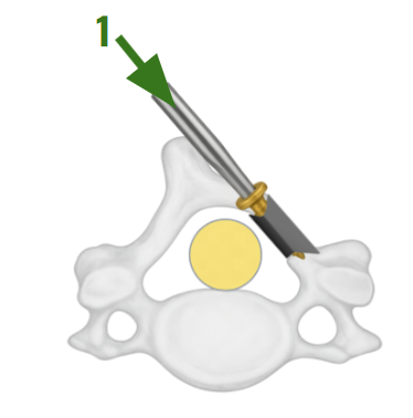 Portico Health, LLC single-screw device